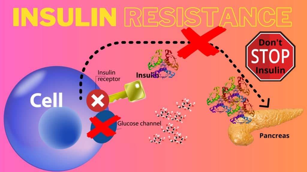 Insulin Resistance-The Silent Killer! 1 Secret You Must Know